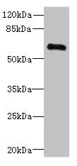 PPP2R1B Antibody - Western blot All Lanes: PPP2R1Bantibody at 3.33ug/ml+ Jurkat whole cell lysate Goat polyclonal to rabbit at 1/10000 dilution Predicted band size: 67,74,62,53 kDa Observed band size: 66 kDa