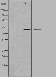 PPP2R1B Antibody - Western blot analysis of extracts of Jurkat cells using PPP2R1B antibody. The lane on the left is treated with the antigen-specific peptide.