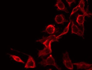 PPP2R1B Antibody - Staining HeLa cells by IF/ICC. The samples were fixed with PFA and permeabilized in 0.1% Triton X-100, then blocked in 10% serum for 45 min at 25°C. The primary antibody was diluted at 1:200 and incubated with the sample for 1 hour at 37°C. An Alexa Fluor 594 conjugated goat anti-rabbit IgG (H+L) Ab, diluted at 1/600, was used as the secondary antibody.