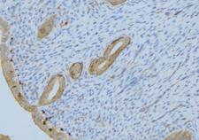 PPP2R1B Antibody - 1:100 staining human uterus tissue by IHC-P. The sample was formaldehyde fixed and a heat mediated antigen retrieval step in citrate buffer was performed. The sample was then blocked and incubated with the antibody for 1.5 hours at 22°C. An HRP conjugated goat anti-rabbit antibody was used as the secondary.