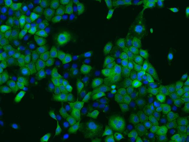 PPP2R1B Antibody - Immunofluorescence staining of PPP2R1B in A431 cells. Cells were fixed with 4% PFA, permeabilzed with 0.1% Triton X-100 in PBS, blocked with 10% serum, and incubated with rabbit anti-Human PPP2R1B polyclonal antibody (dilution ratio 1:200) at 4°C overnight. Then cells were stained with the Alexa Fluor 488-conjugated Goat Anti-rabbit IgG secondary antibody (green) and counterstained with DAPI (blue). Positive staining was localized to Cytoplasm.