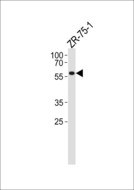 PPP2R2A Antibody - PPP2R2A Antibody western blot of ZR-75-1 cell line lysates (35 ug/lane). The PPP2R2A antibody detected the PPP2R2A protein (arrow).
