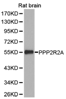 PPP2R2A Antibody - Western blot of extracts of rat brain cell lines, using PPP2R2A antibody.