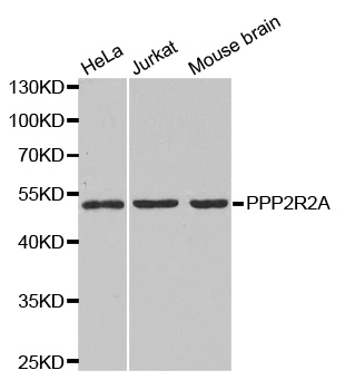 PPP2R2A Antibody - Western blot analysis of extracts of various cell lines, using PPP2R2A antibody.