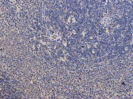 PPP2R2A Antibody - Immunohistochemistry of paraffin-embedded rat brain using PPP2R2A antibody at dilution of 1:100 (200x lens).