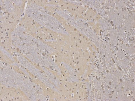 PPP2R2A Antibody - Immunohistochemistry of paraffin-embedded rat spleen using PPP2R2A antibody at dilution of 1:100 (200x lens).
