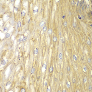 PPP2R2A Antibody - Immunohistochemistry of paraffin-embedded human esophageal tissue.