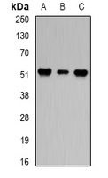 PPP2R2A Antibody - Western blot analysis of PPP2R2A expression in HeLa (A); Jurkat (B); mouse brain (C) whole cell lysates.