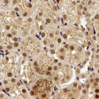 PPP2R2A Antibody - Immunohistochemical analysis of PPP2R2A staining in rat kidney formalin fixed paraffin embedded tissue section. The section was pre-treated using heat mediated antigen retrieval with sodium citrate buffer (pH 6.0). The section was then incubated with the antibody at room temperature and detected using an HRP conjugated compact polymer system. DAB was used as the chromogen. The section was then counterstained with hematoxylin and mounted with DPX.