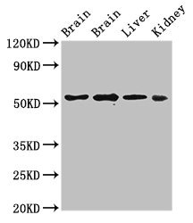 PPP2R2A Antibody - Western Blot Positive WB detected in:Rat brain tissue,Mouse brain tissue,Mouse liver tissue,Mouse kidney tissue All Lanes:PPP2R2A antibody at 3µg/ml Secondary Goat polyclonal to rabbit IgG at 1/50000 dilution Predicted band size: 52,53 KDa Observed band size: 52 KDa