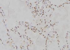 PPP2R2A Antibody - 1:100 staining human lung tissue by IHC-P. The sample was formaldehyde fixed and a heat mediated antigen retrieval step in citrate buffer was performed. The sample was then blocked and incubated with the antibody for 1.5 hours at 22°C. An HRP conjugated goat anti-rabbit antibody was used as the secondary.