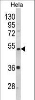 PPP2R2B Antibody - Western blot of PPP2R2B Antibody in HeLa cell line lysates (35 ug/lane). PPP2R2B (arrow) was detected using the purified antibody.