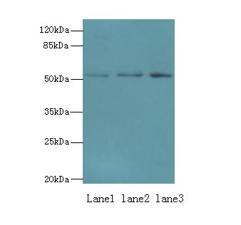 PPP2R2B Antibody - Western blot. All lanes: PPP2R2B antibody at 2 ug/ml. Lane 1: SH-SY5Y whole cell lysate. Lane 2: MDA-MB-231 whole cell lysate. Lane 3: HepG-2 whole cell lysate. Secondary antibody: Goat polyclonal to Rabbit IgG at 1:10000 dilution. Predicted band size: 52 kDa. Observed band size: 52 kDa.