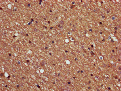 PPP2R2B Antibody - IHC image of PPP2R2B Antibody diluted at 1:600 and staining in paraffin-embedded human brain tissue performed on a Leica BondTM system. After dewaxing and hydration, antigen retrieval was mediated by high pressure in a citrate buffer (pH 6.0). Section was blocked with 10% normal goat serum 30min at RT. Then primary antibody (1% BSA) was incubated at 4°C overnight. The primary is detected by a biotinylated secondary antibody and visualized using an HRP conjugated SP system.