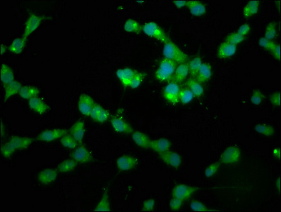 PPP2R2B Antibody - Immunofluorescence staining of SH-SY5Y cells with PPP2R2B Antibody at 1:200, counter-stained with DAPI. The cells were fixed in 4% formaldehyde, permeabilized using 0.2% Triton X-100 and blocked in 10% normal Goat Serum. The cells were then incubated with the antibody overnight at 4°C. The secondary antibody was Alexa Fluor 488-congugated AffiniPure Goat Anti-Rabbit IgG(H+L).
