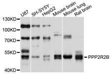 PPP2R2B Antibody - Western blot analysis of extracts of various cell lines, using PPP2R2B antibody at 1:1000 dilution. The secondary antibody used was an HRP Goat Anti-Rabbit IgG (H+L) at 1:10000 dilution. Lysates were loaded 25ug per lane and 3% nonfat dry milk in TBST was used for blocking. An ECL Kit was used for detection and the exposure time was 5s.
