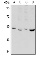 PPP2R2B Antibody - Western blot analysis of PPP2R2B expression in rat brain (A), Hela (B), C6 (C), mouse brain (D) whole cell lysates.