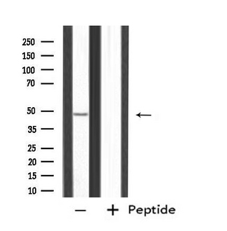 PPP2R2B Antibody - Western blot analysis of extracts of HeLa cells using PPP2R2B antibody.