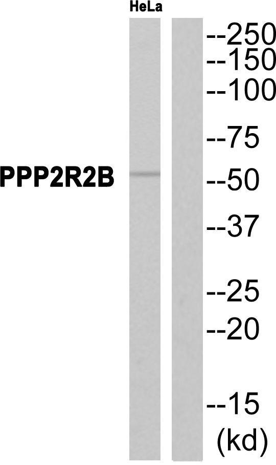 PPP2R2B Antibody - Western blot analysis of extracts from HeLa cells, using PPP2R2B antibody.