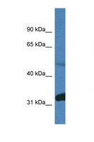 PPP2R2D Antibody - PPP2R2D antibody Western blot of Mouse Brain lysate. Antibody concentration 1 ug/ml. This image was taken for the unconjugated form of this product. Other forms have not been tested.