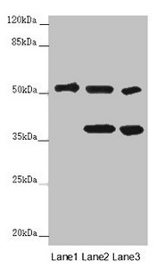 PPP2R2D Antibody - Western blot All Lanes :PPP2R2D antibody at 2 ug/ml Lane 1 : SH-SY5Y whole cell lysate Lane 2 : Hela whole cell lysate Lane 3 : 293T whole cell lysate Secondary Goat polyclonal to rabbit IgG at 1/10000 dilution Predicted band size: 52 kDa Observed band size: 52,40 kDa