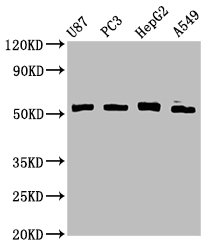 PPP2R2D Antibody - Western Blot Positive WB detected in: U87 whole cell lysate, PC-3 whole cell lysate, HepG2 whole cell lysate, A549 whole cell lysate All lanes: PPP2R2D antibody at 3.3µg/ml Secondary Goat polyclonal to rabbit IgG at 1/50000 dilution Predicted band size: 53 kDa Observed band size: 53 kDa