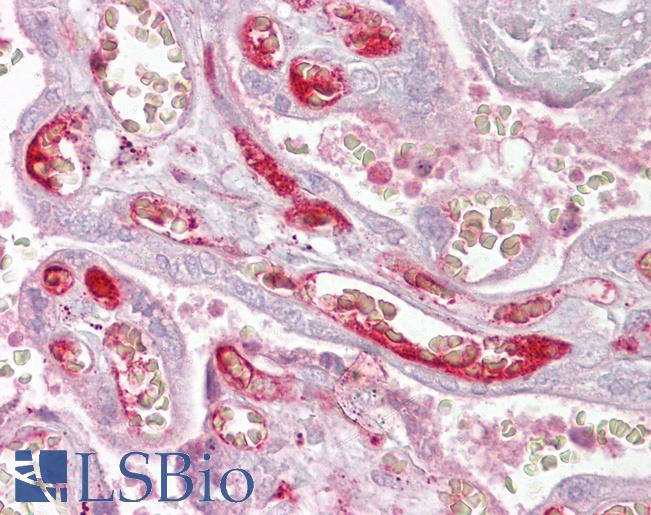 PPP2R3A / PR130 Antibody - Anti-PPP2R3A antibody IHC of human placenta. Immunohistochemistry of formalin-fixed, paraffin-embedded tissue after heat-induced antigen retrieval. Antibody concentration 5 ug/ml.  This image was taken for the unconjugated form of this product. Other forms have not been tested.