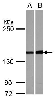 PPP2R3A / PR130 Antibody - Sample (30 ug of whole cell lysate) A: NT2D1 B: U87-MG 5% SDS PAGE PPP2R3A antibody diluted at 1:1000