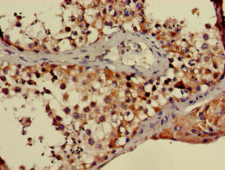 PPP2R3A / PR130 Antibody - Immunohistochemistry of paraffin-embedded human testis tissue using PPP2R3A Antibody at dilution of 1:100
