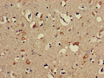 PPP2R3A / PR130 Antibody - Immunohistochemistry of paraffin-embedded human brain tissue using PPP2R3A Antibody at dilution of 1:100
