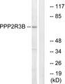 PPP2R3B Antibody - Western blot analysis of lysates from K562 cells, using PPP2R3B Antibody. The lane on the right is blocked with the synthesized peptide.