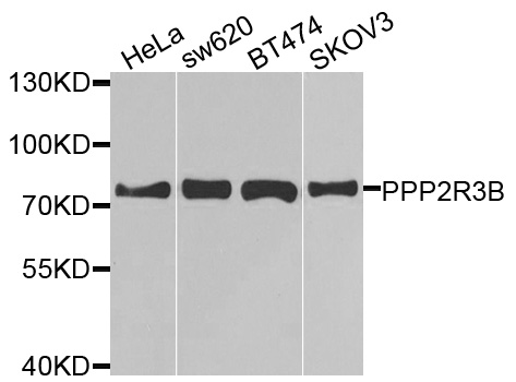 PPP2R3B Antibody - Western blot analysis of extracts of various cells.