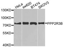 PPP2R3B Antibody - Western blot analysis of extracts of various cells.