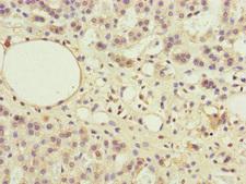 PPP2R3B Antibody - Immunohistochemistry of paraffin-embedded human adrenal gland tissue at dilution of 1:100