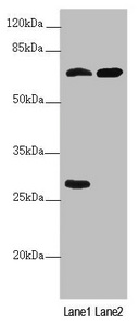 PPP2R3B Antibody - Western blot All Lanes:PPP2R3B antibody at 2.1 ug/ml Lane 1: Jurkat whole cell lysate Lane 2: HL60 whole cell lysate Secondary Goat polyclonal to rabbit IgG at 1/10000 dilution Predicted band size: 66,21 kDa Observed band size: 65,28 kDa