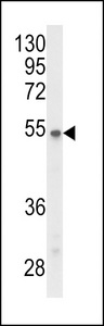 PPP2R3C Antibody - Western blot of P2R3C Antibody in Y79 cell line lysates (35 ug/lane). P2R3C (arrow) was detected using the purified antibody.