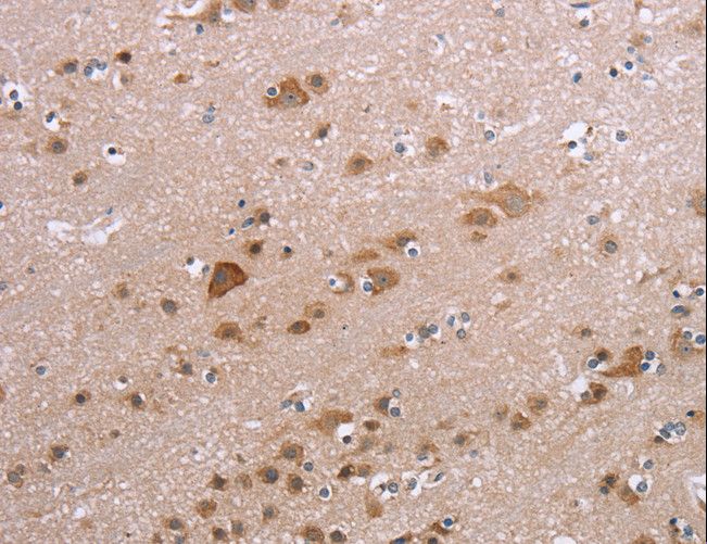 PPP2R3C Antibody - Immunohistochemistry of paraffin-embedded Human brain using PPP2R3C Polyclonal Antibody at dilution of 1:30.