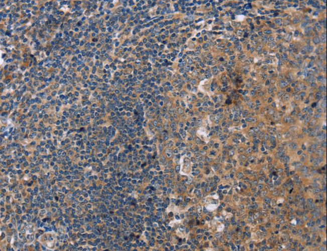PPP2R3C Antibody - Immunohistochemistry of paraffin-embedded Human tonsil using PPP2R3C Polyclonal Antibody at dilution of 1:30.
