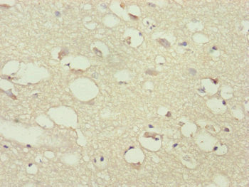PPP2R3C Antibody - Immunohistochemistry of paraffin-embedded human brain tissue at dilution of 1:100