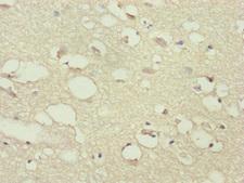 PPP2R3C Antibody - Immunohistochemistry of paraffin-embedded human brain tissue at dilution of 1:100