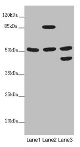 PPP2R3C Antibody - Western blot All Lanes:PPP2R3C antibody at 5.11 ug/ml Lane 1: HepG-2 whole cell lysate Lane 2: Jurkat whole cell lysate Lane 3: A549 whole cell lysate Secondary Goat polyclonal to rabbit IgG at 1/10000 dilution Predicted band size: 54,40 kDa Observed band size: 53,85,45 kDa