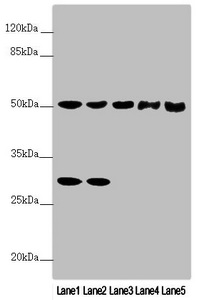 PPP2R3C Antibody - Western blot All Lanes:PPP2R3C antibody at 3.76 ug/ml Lane 1: Mouse stomach tissue Lane 2: Mouse brain tissue Lane 3: A431 whole cell lysate Lane 4: Jurkat whole cell lysate Lane 5: A549 whole cell lysate Secondary Goat polyclonal to rabbit IgG at 1/10000 dilution Predicted band size: 54,40 kDa Observed band size: 53,30 kDa