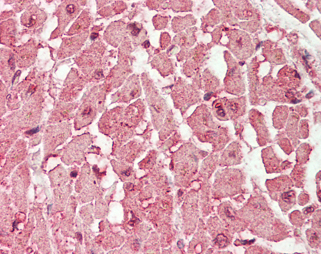 PPP2R4 Antibody - Human Heart: Formalin-Fixed, Paraffin-Embedded (FFPE).  This image was taken for the unconjugated form of this product. Other forms have not been tested.