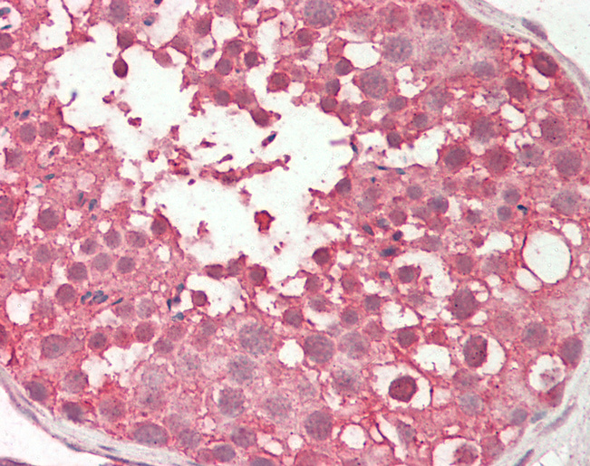PPP2R4 Antibody - Human Testis: Formalin-Fixed, Paraffin-Embedded (FFPE).  This image was taken for the unconjugated form of this product. Other forms have not been tested.