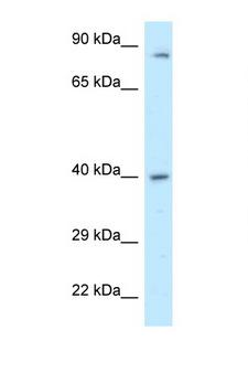 PPP2R4 Antibody - PPP2R4 antibody Western blot of 721_B Cell lysate. Antibody concentration 1 ug/ml.  This image was taken for the unconjugated form of this product. Other forms have not been tested.