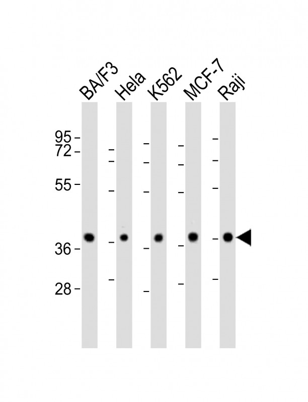 PPP2R4 Antibody - All lanes: Anti-PPP2R4 Antibody (N-Term) at 1:2000 dilution. Lane 1: BA/F3 whole cell lysate. Lane 2: HeLa whole cell lysate. Lane 3: K562 whole cell lysate. Lane 4: MCF-7 whole cell lysate. Lane 5: Raji whole cell lysate Lysates/proteins at 20 ug per lane. Secondary Goat Anti-Rabbit IgG, (H+L), Peroxidase conjugated at 1:10000 dilution. Predicted band size: 41 kDa. Blocking/Dilution buffer: 5% NFDM/TBST.