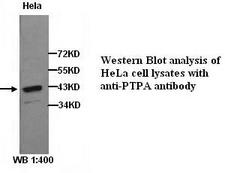 PPP2R4 Antibody