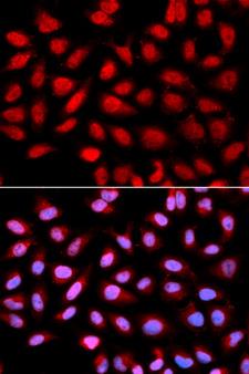 PPP2R4 Antibody - Immunofluorescence analysis of U2OS cells.