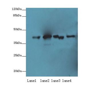 PPP2R4 Antibody - Western blot. All lanes: PPP2R4 antibody at 10 ug/ml. Lane 1: K562 whole cell lysate. Lane 2: MCF7 whole cell lysate. Lane 3: A431 whole cell lysate. Lane 4: Raji whole cell lysate. Secondary Goat polyclonal to Rabbit IgG at 1:10000 dilution. Predicted band size: 41 kDa. Observed band size: 41 kDa.