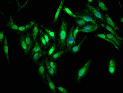 PPP2R4 Antibody - Immunofluorescence staining of Hela cells with PPP2R4 Antibody at 1:333, counter-stained with DAPI. The cells were fixed in 4% formaldehyde, permeabilized using 0.2% Triton X-100 and blocked in 10% normal Goat Serum. The cells were then incubated with the antibody overnight at 4°C. The secondary antibody was Alexa Fluor 488-congugated AffiniPure Goat Anti-Rabbit IgG(H+L).